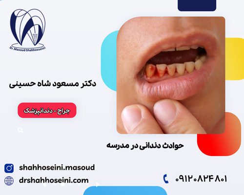 حوادث دندانی در مدارس