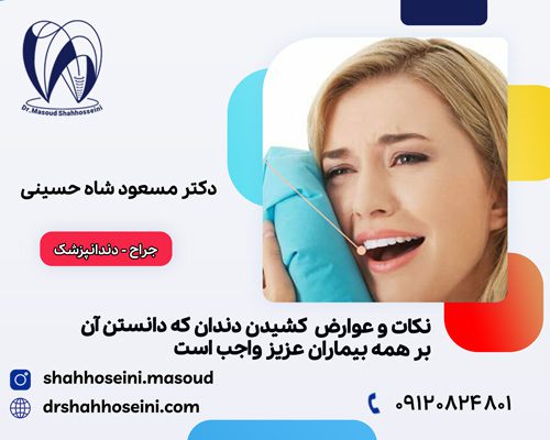 کشیدن دندان