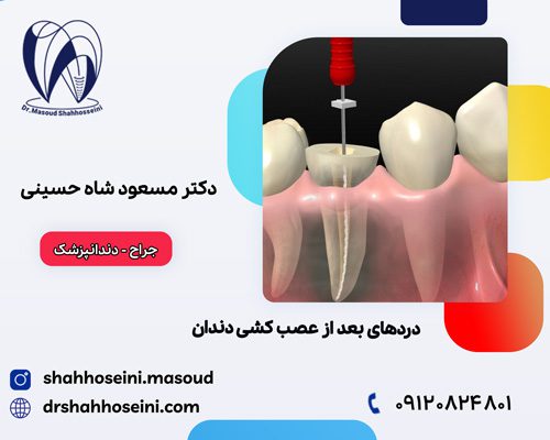 دردهای بعد از عصب کشی دندان