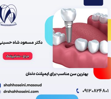 بهترین سن مناسب برای ایمپلنت دندان