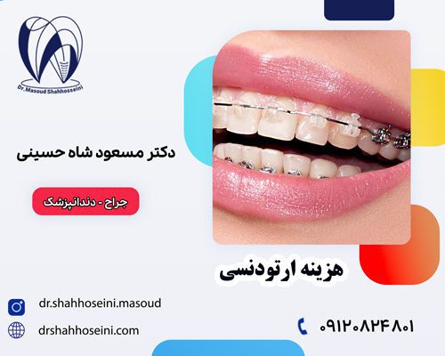 هزینه ارتودنسی