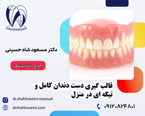 قالب گیری دست دندان کامل و تیکه ای در منزل