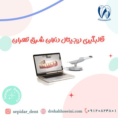 قالبگیری دیجیتال دندان شرق تهران