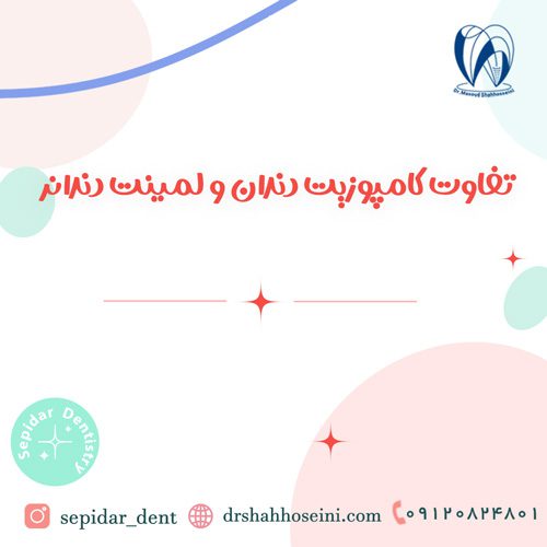 تفاوت کامپوزیت دندان و لمینت دندان