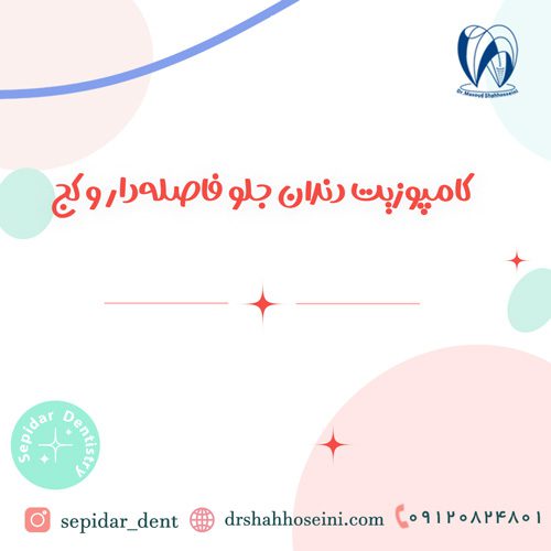 کامپوزیت دندان جلو فاصله‌دار و کج