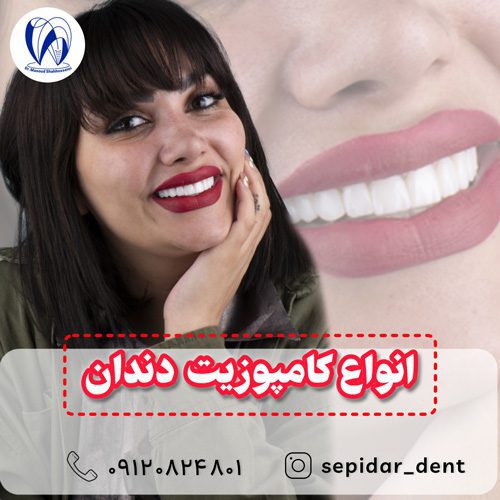انواع کامپوزیت دندان