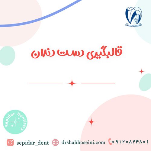 قالبگیری دست دندان