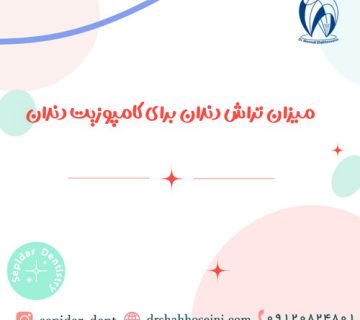 میزان تراش دندان برای کامپوزیت دندان