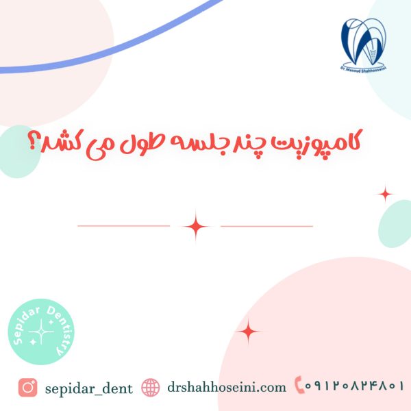 کامپوزیت چند جلسه طول می کشد؟
