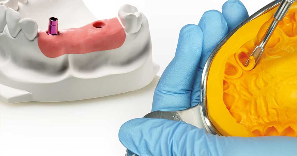 خدمات پروتز دندان در منزل در دندانپزشکی سپیدار