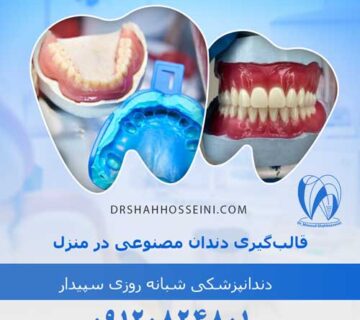قالب‌گیری دندان مصنوعی در منزل