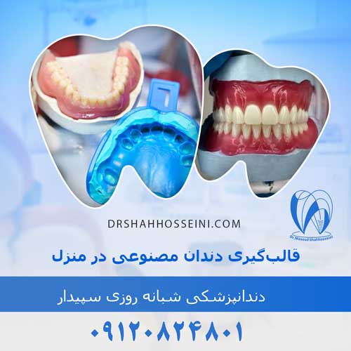 قالب‌گیری دندان مصنوعی در منزل
